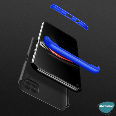 Microsonic Huawei P40 Lite Kılıf Double Dip 360 Protective AYS Siyah Mavi