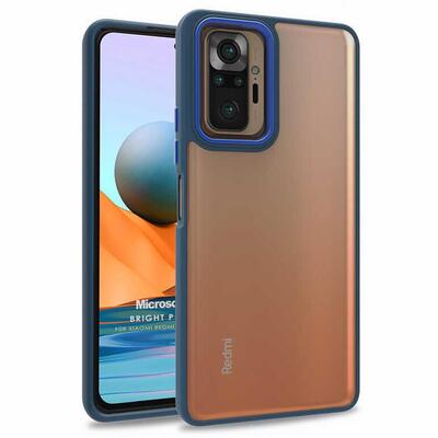 Microsonic Xiaomi Redmi Note 10 Pro Kılıf Bright Planet Lacivert