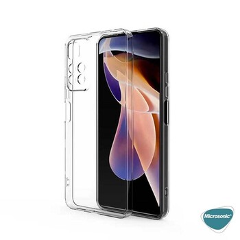 Microsonic Xiaomi Redmi Note 11 Pro Plus Kılıf Transparent Soft Beyaz