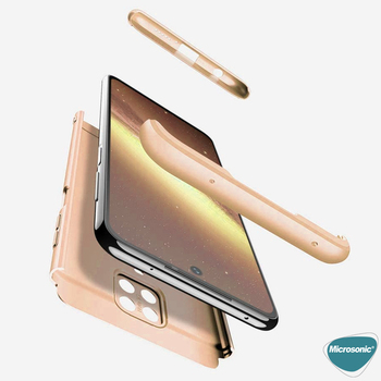 Microsonic Xiaomi Redmi Note 9 Pro Kılıf Double Dip 360 Protective AYS Gold